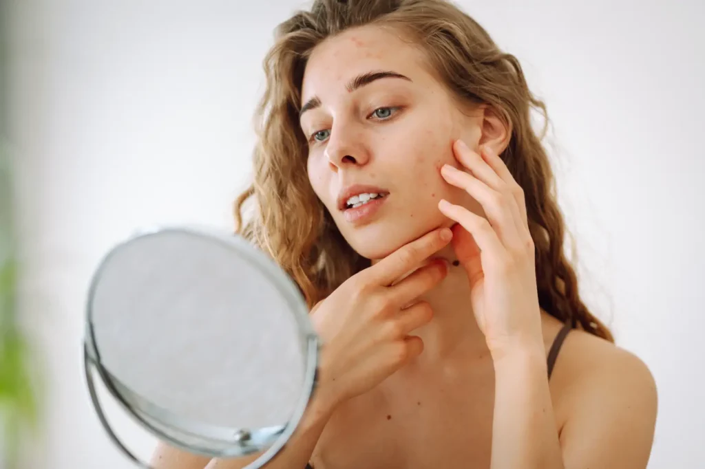 Woman looking into a round mirror while touching her cheek and jaw, with red spots visible on her face.